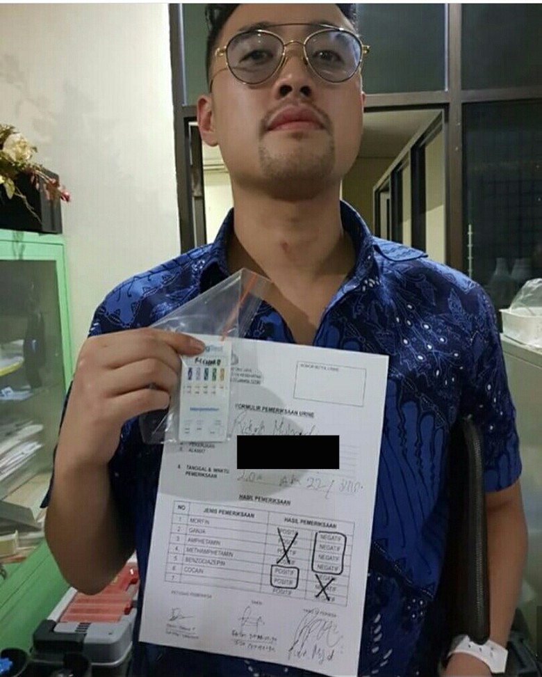 Ini iPhone X dan Dolar yang Dipakai Richard Muljadi Isap Kokain Ini iPhone X dan Dolar yang Dipakai Richard Muljadi Isap Kokain