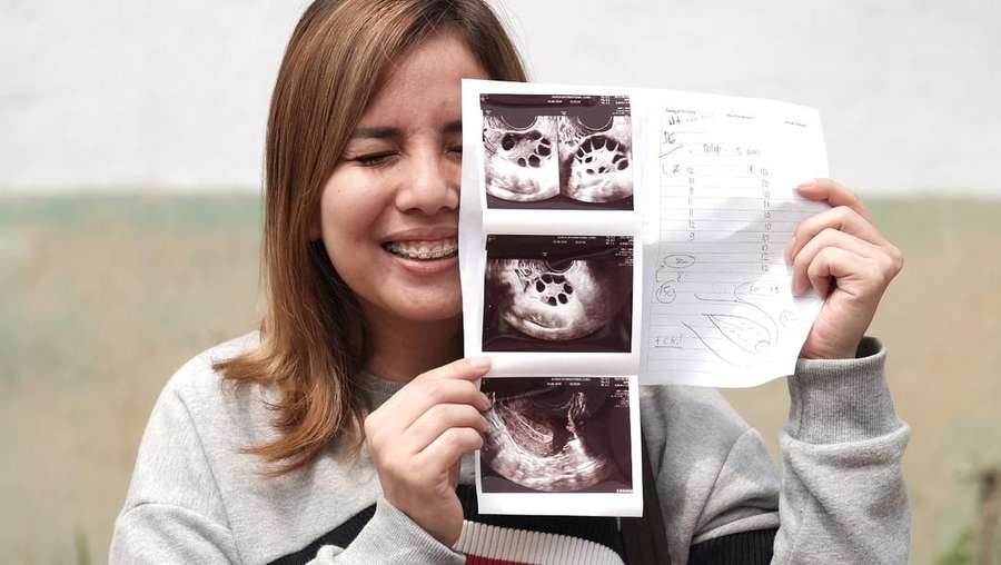 Ingin Punya Anak Kedua, Tya Ariestya Jalani Program Bayi 