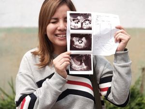 Jalani Proses Bayi Tabung, Tya Ariestya Alami Perubahan