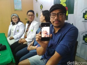 Takut Darah, Sammy Simorangkir Tetap Dampingi Viviane Melahirkan