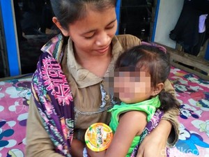 Ini Kata Kadinkes Soal Balita Stunting di Jember