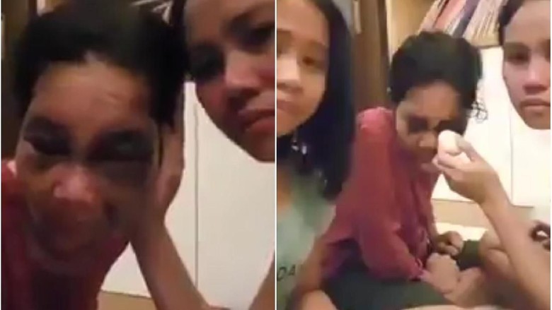 Sempat Viral Karena Lebam, TKW di Malaysia Akhirnya Dipulangkan Sempat Viral Karena Lebam, TKW di Malaysia Akhirnya Dipulangkan