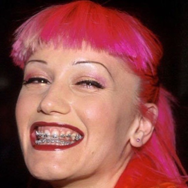 Begitu juga dengan Gwen Stefani yang sepertinya mencabut habis alisnya agar bisa digambar super tipis. Foto: Instagram @historyofoverplucking