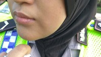 Lukanya ada di bawah mata kiri. Foto: Hilda/detikcom