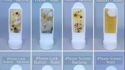 Berbagai penelitian telah menyebut bahwa smartphone terpapar lebih banyak bakteri dibanding toilet. Foto-foto ini jadi bukti atas kenyataan tersebut.