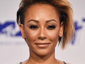 Pro Kontra Tindakan Vaginal Scraping yang Dilakukan Mel B