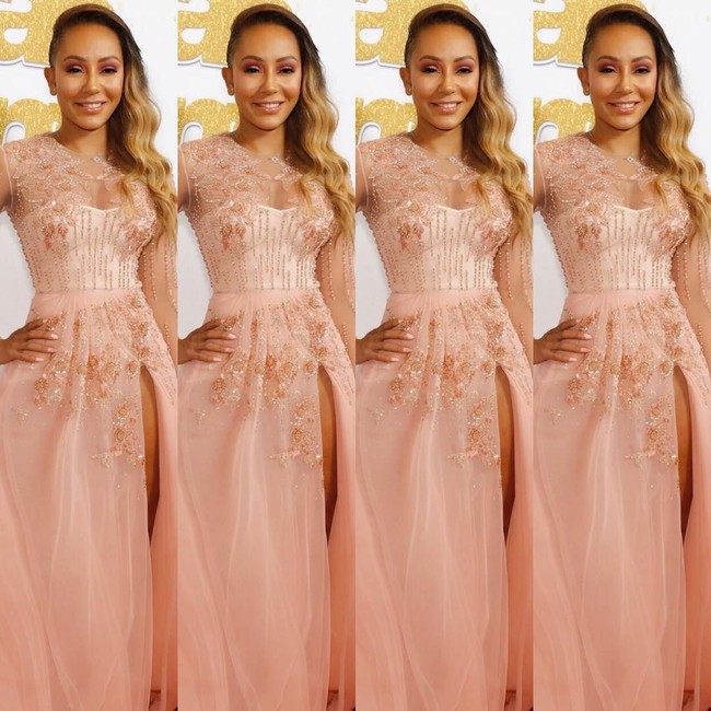 Mel B mengungkapkan di Instagram bahwa dia menjalani tindakan non bedah untuk membuat wajahnya kembali muda. Dan prosedur kecantikan yang dijalaninya itu kabarnya menghabiskan biaya hingga 4.000 poundsterling atau sekitar Rp 75 jutaan. Foto: Instagram