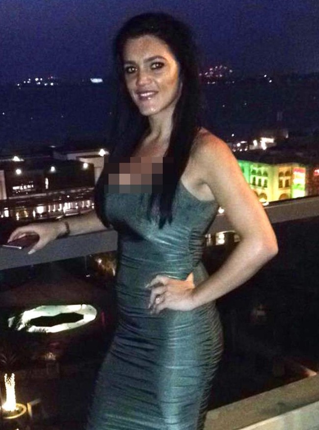 Belum sempat menikmati hasil operasi yang membuat bokongnya lebih bervolume, Leah Cambridge harus tewas. Wanita 29 tahun itu menjalani operasi pembesaran bokong dengan mentransfer lemak dari bagian tubuh lain ke bokong, dengan biaya Rp 57 juta. Setelah operasi plastik, Leah meninggal akibat komplikasi. Padahal operasi dilakukan di klinik terpercaya di Turki. Foto: Facebook