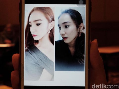 Operasi Hidung Jadi Favorit Orang Indonesia di Thailand, Berapa Harganya?