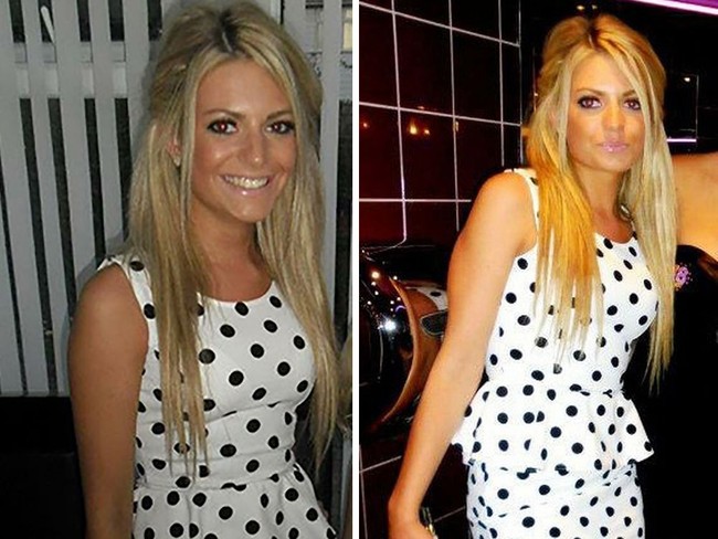 Ini penampilan Meg di masa lalu. Bibir Meg dulu tipis tapi kini terlihat lebih bervolume. Bibir seksinya kini diduga dari hasil filler. Foto: dok. Hello Magazine