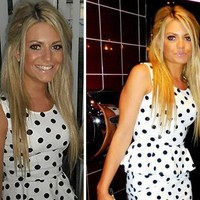 Ini penampilan Meg di masa lalu. Bibir Meg dulu tipis tapi kini terlihat lebih bervolume. Bibir seksinya kini diduga dari hasil filler. Foto: dok. Hello Magazine