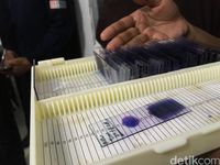 Pemeriksaan malaria.