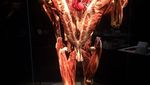 Belajar Organ Manusia di Museum Jenazah, Ngeri atau Keren?