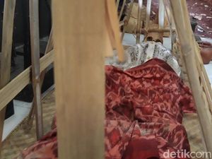 Ini Lho Koleksi Paling Berharga di Museum Kematian Unair