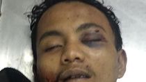 Kata Warga Soal Ami, Begal Bandung yang Tewas Didor Polisi Kata Warga Soal Ami, Begal Bandung yang Tewas Didor Polisi