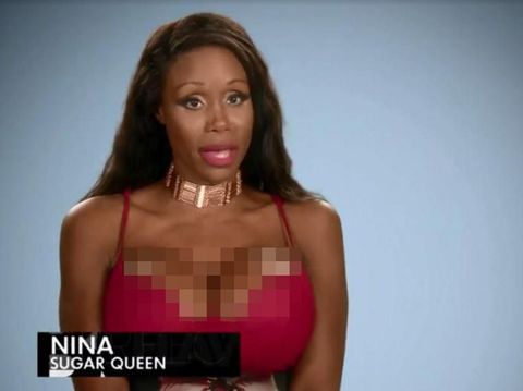 Kisah Wanita yang 4 Kali Oplas Payudara hingga Tragedi Puting Melebar