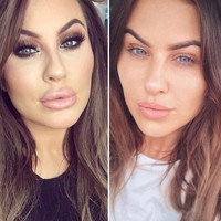 Begini penampilan selebgram yang awalnya berbibir tebal hasil filler dan tanpa filler. Foto before-after ini memperlihatkan bibir Jade tadinya tebal dan tampak tak alami. Kini bibir tebalnya jadi kempes dan terlihat lebih natural.  Foto: Instagram (@jadekaty)