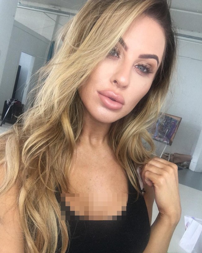 Inilah momen saat bibir Jade masih tebal oleh filler. Wanita 26 tahun itu mengaku kini lebih nyaman dengan bibir yang lebih tipis.  Foto: Instagram (@jadekaty)