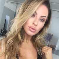 Inilah momen saat bibir Jade masih tebal oleh filler. Wanita 26 tahun itu mengaku kini lebih nyaman dengan bibir yang lebih tipis.  Foto: Instagram (@jadekaty)