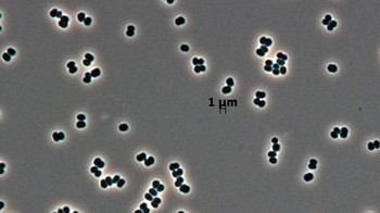 Jumlah mikroba di seluruh dunia bisa mencapai 3.170 octillion (3.170 dengan 27 nol di belakang). (Foto: NASA)