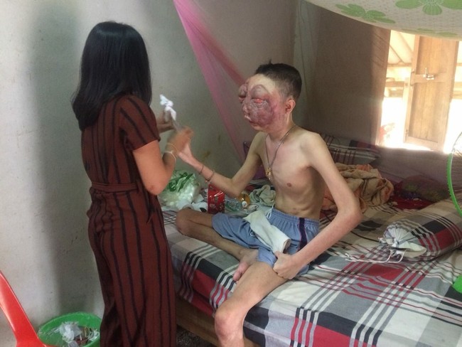 Melansir dari The Sun, keluarga Pooh mengungkapkan bahwa kondisinya tidak memiliki pilihan untuk pengobatan lain. Foto: Dok. Facebook Atittaya Chumkeaw