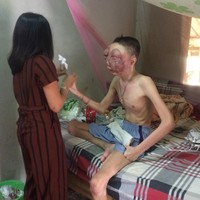 Melansir dari The Sun, keluarga Pooh mengungkapkan bahwa kondisinya tidak memiliki pilihan untuk pengobatan lain. Foto: Dok. Facebook Atittaya Chumkeaw