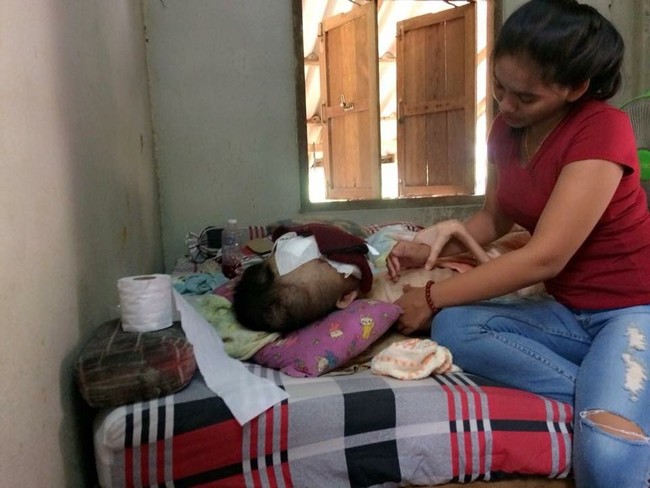 Namun, Atittaya masih berharap pujaan hatinya bisa mendapat keajaiban dan tumor di wajahnya akan hilang. Foto: Dok. Facebook Atittaya Chumkeaw