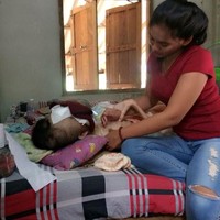 Namun, Atittaya masih berharap pujaan hatinya bisa mendapat keajaiban dan tumor di wajahnya akan hilang. Foto: Dok. Facebook Atittaya Chumkeaw