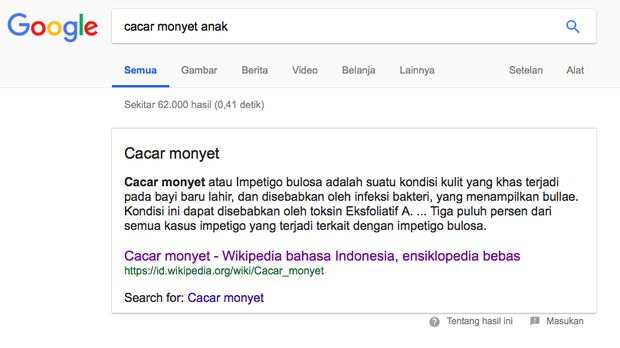 Salah satu hasil pencarian 'cacar monyet' di Google mengarahkan pada artikel tentang impetigo, kondisi kulit yang menyebabkan anak gatal-gatal.