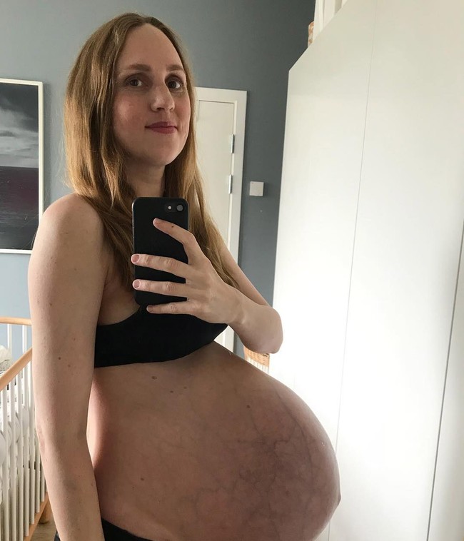Pada foto ini usia kehamilan Maria sudah 35 minggu. Dan foto ini menjadi foto perut hamil terakhir yang diunggahnya ke Instagram karena setelahnya ketiga bayinya akan dilahirkan. Foto: Instagram @triplets_of_copenhagen
