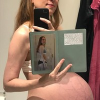 Seiring bertambahnya usia kehamilan Maria, perutnya semakin membesar dan maju. Maria pun membuat potret yang memperlihatkan bagaimana bentuk perutnya berubah hanya dalam rentang beberapa hari. Foto: Instagram @triplets_of_copenhagen