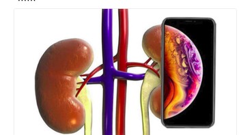 Tak heran, jual ginjal kerap terjadi untuk bisa mendapatkan ponsel iphone dengan harga selangit. (Foto: Twitter)