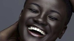 Khoudia Diop adalah model sukses ternama dengan kulit hitamnya. Ternyata, ia tak lepas dari bully di masa mudanya.