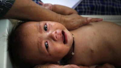 Mencegah Gizi Buruk di Kaduhejo, Pandeglang