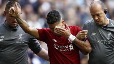 Ouch! Ketika Mata Firmino Tercolok Jari Vertonghen