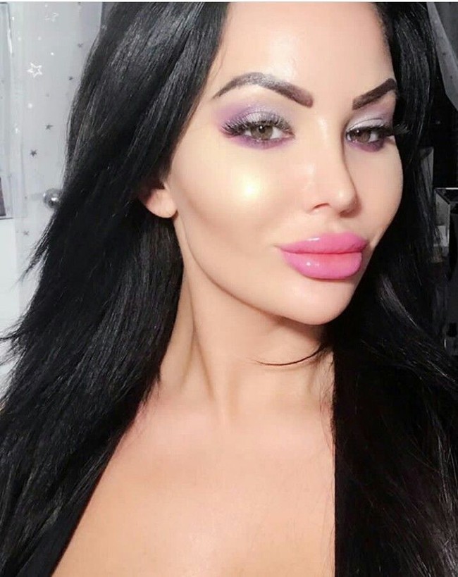 Sejak saat itu, dia mengumpulkan setiap uang yang dia punya untuk menyempurnakan penampilannya. Star pun jadi tergila-gila dengan operasi plastik. Foto: Dok. Instagram @StarDelguidice