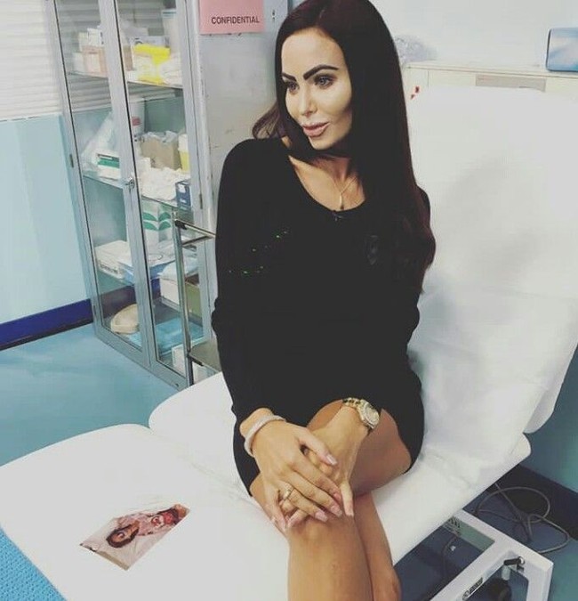 Saat usia 17, pertama kalinya Star melakukan operasi pembesaran payudara. Saat itu Star sudah bekerja sebagai pole dancer. Foto: Dok. Instagram @StarDelguidice