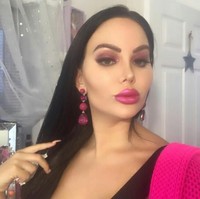 Kini Star mengaku mengalami masalah kecemasan. Ia kerap merasa ketakutan implan bokongnya akan meledak. Hal tersebut karena implannya bergerak-gerak ketika ia berjalan. Foto: Dok. Instagram @StarDelguidice