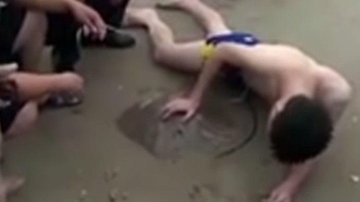 Ouch! Penis Pria Ini Tersengat Ikan Pari Saat Berenang di Laut