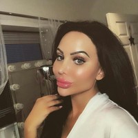 Wanita yang terobsesi operas plastik Star Delguidice telah melakukan 200 kali oplas. Dia melakoni rekonstruksi kecantikan sejak usia 17 hingga kini umurnya 28. Foto: Dok. Instagram @StarDelguidice