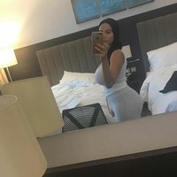 Namun operasi pembesaran bokong yang terakhir membuat Star dilanda kepanikan. Karena terlalu besar, ia takut bokongnya akan meledak. Foto: Dok. Instagram @StarDelguidice