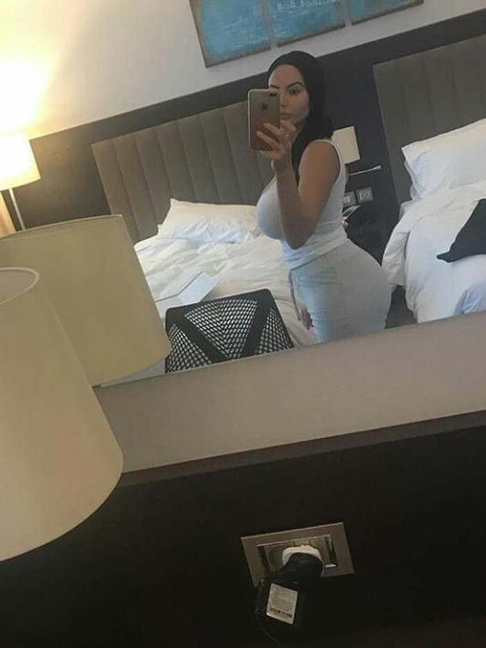 Star Delguidice, wanita operasi plastik