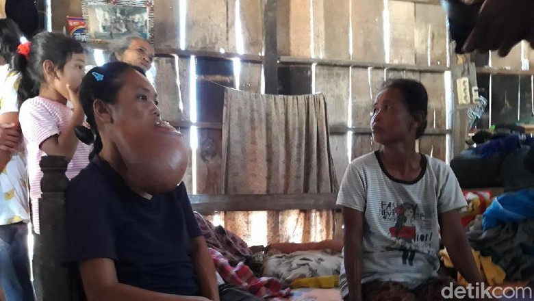Menjenguk Sukinem yang 9 Tahun Menderita Kanker di Boyolali Menjenguk Sukinem yang 9 Tahun Menderita Kanker di Boyolali
