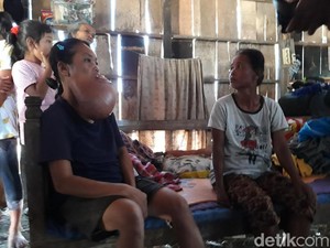Menjenguk Sukinem yang 9 Tahun Menderita Kanker di Boyolali