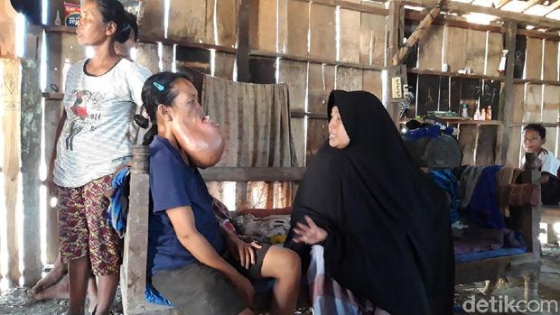 Penderita kanker, Sukinem saat ditemui di rumahnya. 