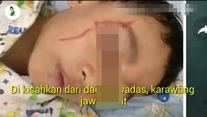 Bocah ini dikabarkan matanya berdarah karena kelamaan main gadget. Videonya viral di medsos (Foto: capture) Bocah ini dikabarkan matanya berdarah karena kelamaan main gadget. Videonya viral di medsos (Foto: capture)