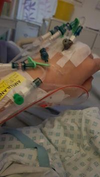 Pria Ini Ditabrak Truk Tapi Selamat karena Punya Perut Six Pack