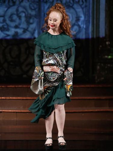 Mimpi Besar Model Down Syndrome Bisa Cetak Sejarah di Show Victoria's Secret
