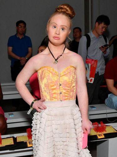 Mimpi Besar Model Down Syndrome Bisa Cetak Sejarah di Show Victoria's Secret