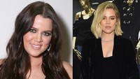 Khloe Kardashian secara terbuka mengatakan bahwa dirinya kerap melakukan operasi plastik. Beragam prosedur dilakukannya hingga salah satu yang dibencinya yakni filler. Dok. Getty Images